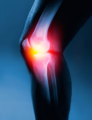 CRPS TREATMENT