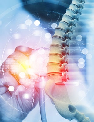 EPIDURAL INJECTIONS