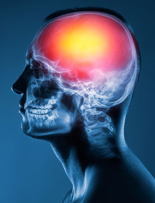 NEUROMODULATION
