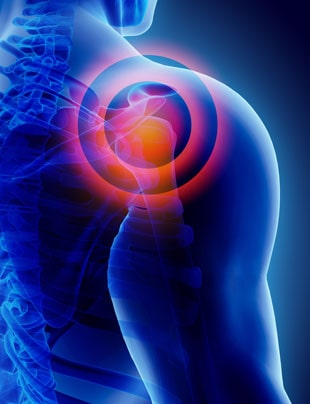 PRP FOR SHOULDER PAIN