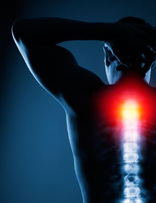 SPINAL CORD STIMULATOR