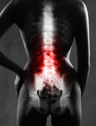 SPINAL INJECTIONS